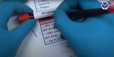 cong bang binh dang trong tiep can dich vu phong chong hiv aids