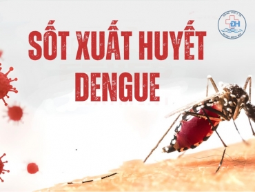 loi ich khi tiem ngua vaccine pho ?ng be ?nh so ?t xua ?t huye ?t